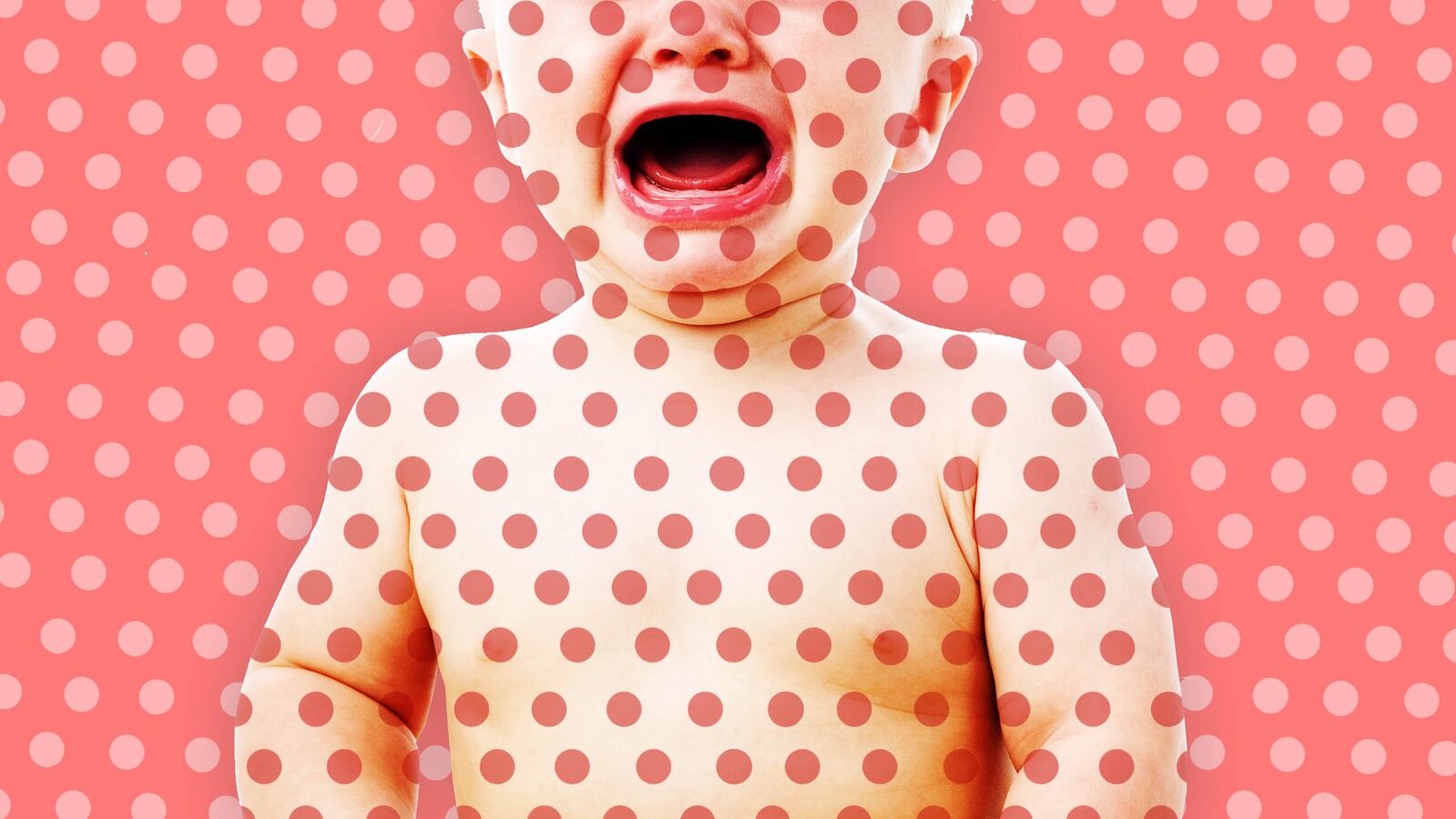 1811203-Wetsman-measles-outbreak-tease_uz2lc3