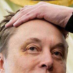 Elon Musk shows a bruised eye that Musk claimed he received at the hands of his son, X Æ A-12, as he attends a press conference with U.S. President Donald Trump in the Oval Office at the White House in Washington, D.C., U.S., May 30, 2025.