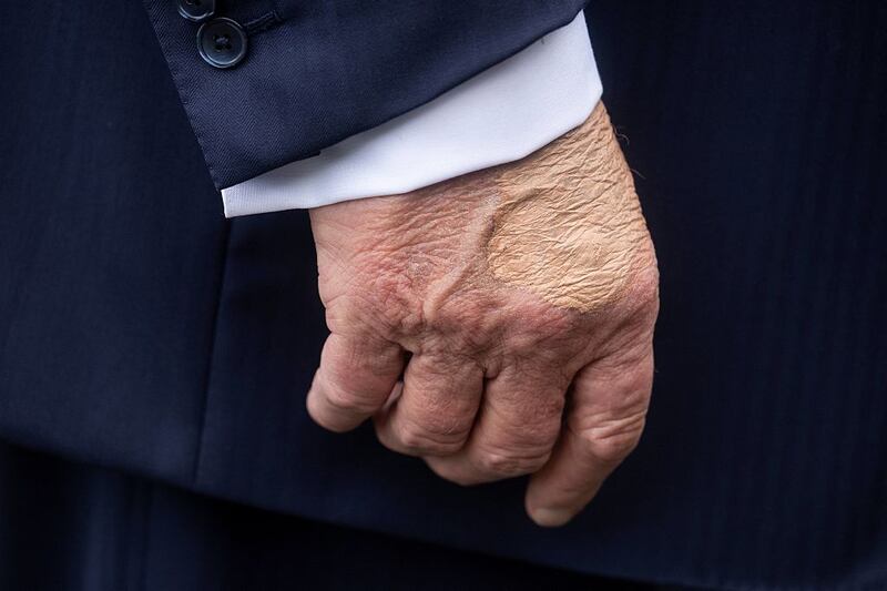 US President Donald Trump's right hand is seen as he speaks to the press before boarding Marine One on the South Lawn of the White House on July 15, 2025, in Washington, DC. Trump is travelling to Pittsburgh, Pennsylvania, to speak at the Pennsylvania Energy and Innovation Summit on the campus of Carnegie Mellon University. (Photo by Jim WATSON / AFP) (Photo by JIM WATSON/AFP via Getty Images)